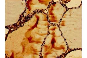 Immunohistochemistry of paraffin-embedded human thyroid tissue using ABIN7167354 at dilution of 1:100 (RAB5 antibody  (AA 1-215))