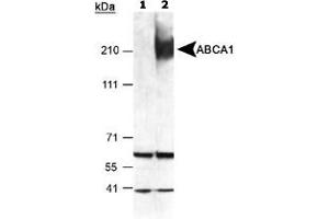 Detection of ABCA1 in mouse peritoneal macrophages using ABCA1 polyclonal antibody . (ABCA1 antibody  (AA 1100-1300))
