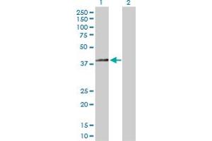 Western Blot analysis of HSD3B2 expression in transfected 293T cell line by HSD3B2 MaxPab polyclonal antibody.