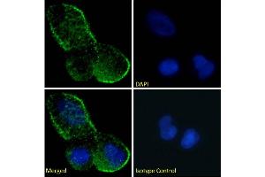 Immunofluorescence staining of fixed MCF7 cells with anti-Fas antibody R-125224. (Recombinant FAS antibody)