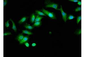 Immunofluorescence staining of Hela cells with ABIN7173964 at 1:133, counter-stained with DAPI.