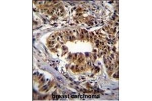 Immunohistochemistry (Paraffin-embedded Sections) (IHC (p)) image for anti-Carbamoyl-Phosphate Synthetase 2, Aspartate Transcarbamylase, and Dihydroorotase (CAD) (AA 780-809) antibody (ABIN655062)