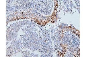 IHC analysis of PYROXD1 using anti-PYROXD1 antibody (ABIN6719650). (PYROXD1 antibody  (AA 48-230))