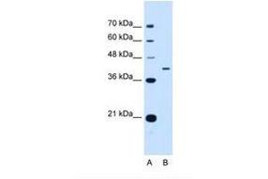 Image no. 1 for anti-Apolipoprotein H (Beta-2-Glycoprotein I) (APOH) (AA 71-120) antibody (ABIN6738750) (APOH antibody  (AA 71-120))