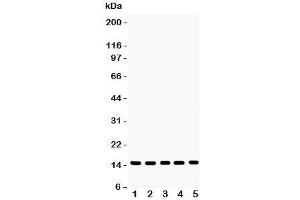 Western blot testing of Profilin-1 antibody and Lane 1:  rat testis;  2: mouse testis;  3: human placenta;  4: (h) PANC;  5: (h) SW620 lysate.