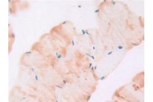 Immunohistochemistry (IHC) image for anti-Interleukin 6 Signal Transducer (Gp130, Oncostatin M Receptor) (IL6ST) (AA 238-500) antibody (ABIN7430555)