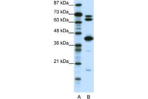 WB Suggested Anti-E2F2 Antibody Titration: 0. (E2F2 antibody  (Middle Region))