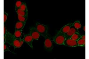 Immunocytochemistry (ICC) image for anti-Epithelial Cell Adhesion Molecule (EPCAM) (AA 77-202), (Extracellular Domain) antibody (ABIN6383801)