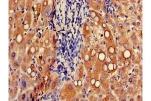 Immunohistochemistry of paraffin-embedded human liver tissue using ABIN7174631 at dilution of 1:100 (UGT1A9 antibody  (AA 277-473))