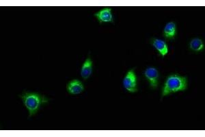 Immunofluorescence staining of A549 cells with ABIN7160157 at 1:150, counter-stained with DAPI. (SLC16A11 antibody  (AA 428-471))