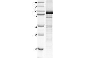Recombinant SETMAR protein gel. (SETMAR Protein (DYKDDDDK Tag))