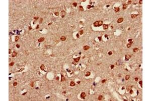 Immunohistochemistry of paraffin-embedded human brain tissue using ABIN7158098 at dilution of 1:100 (SHoc2/Sur8 antibody  (AA 3-89))