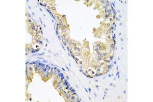 Immunohistochemistry of paraffin-embedded human prostate using SPINT2 antibody (ABIN5974082) at dilution of 1/200 (40x lens). (SPINT2 antibody)