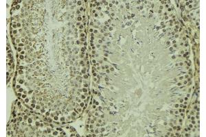 ABIN6269090 at 1/100 staining Mouse testis tissue by IHC-P. (Integrin beta 3 antibody  (C-Term))