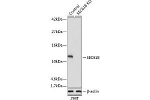 Western blot analysis of extracts from normal (control) and SEC61B knockout (KO) 293T cells, using SEC61B antibody (ABIN7270173) at 1:1000 dilution. (SEC61B antibody  (AA 1-96))
