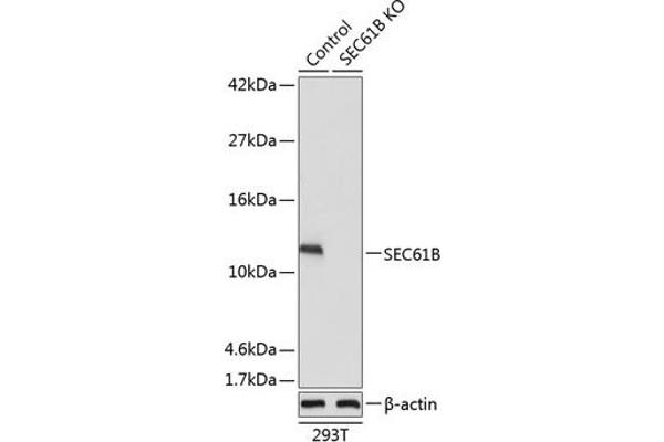 SEC61B 抗体  (AA 1-96)