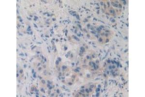 Immunohistochemistry (IHC) image for anti-Interleukin-27 subunit beta (IL-27b) (AA 21-229) antibody (ABIN7426622)