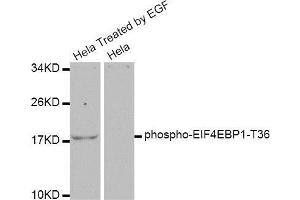 Western blot analysis of extracts of various cell lines, using EIF4EBP1 antibody. (eIF4EBP1 antibody  (pThr37, pThr46))