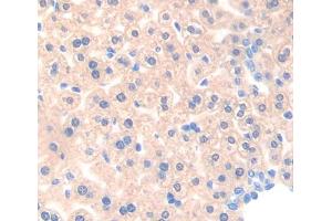IHC-P analysis of liver tissue, with DAB staining. (ACAA1 antibody  (AA 182-424))