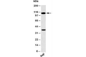 Western blot testing of human samples with TLR9 antibody at 2ug/ml. (TLR9 antibody  (N-Term))
