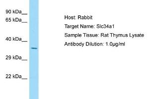Host: Rabbit Target Name: Slc34a1 Sample Type: Rat Thymus lysates Antibody Dilution: 1. (Solute Carrier Family 34 (Type II Sodium/phosphate Contransporter), Member 1 (SLC34A1) (N-Term) antibody)