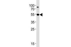 Western Blotting (WB) image for anti-V-Akt Murine Thymoma Viral Oncogene Homolog 3 (Protein Kinase B, Gamma) (AKT3) (AA 88-118) antibody (ABIN3029482)