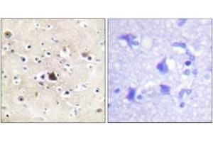 Immunohistochemistry (IHC) image for anti-Nuclear Receptor Subfamily 3, Group C, Member 1 (Glucocorticoid Receptor) (NR3C1) (AA 201-250) antibody (ABIN2888632) (Glucocorticoid Receptor antibody  (AA 201-250))