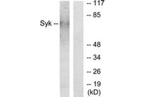 Western blot analysis of extracts from HepG2 cells, using SYK Antibody.