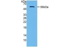 Detection of Recombinant AASS, Human using Polyclonal Antibody to Aminoadipate Semialdehyde Synthase (AASS) (AASS antibody  (AA 33-455))