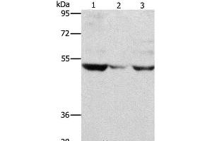 Western Blot analysis of PC3 cell and Mouse muscle tissue, A375 cell using MMP1 Polyclonal Antibody at dilution of 1:500 (MMP1 antibody)