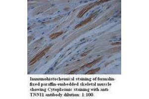 Image no. 1 for anti-Slow Skeletal Troponin I (TNNI1) (N-Term) antibody (ABIN791026) (TNNI1 antibody  (N-Term))
