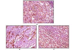 Immunohistochemical analysis of paraffin-embedded human lymph tissue (A), glioma tissue (B) and cerebellum tissue (C), showing membrane localization using Dynamin1 mouse mAb with DAB staining