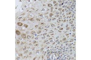 Immunohistochemistry of paraffin-embedded human esophagus using PRKAB1 antibody. (PRKAB1 antibody  (AA 1-80))