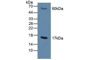 Figure. (MGST1 antibody  (AA 8-155))