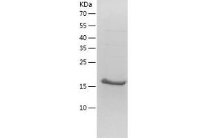 Western Blotting (WB) image for Nudix (Nucleoside Diphosphate Linked Moiety X)-Type Motif 4 (NUDT4) (AA 1-180) protein (His tag) (ABIN7289146) (NUDT4 Protein (AA 1-180) (His tag))