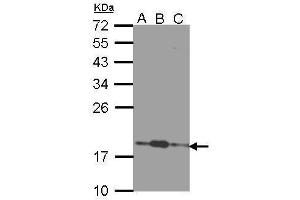 WB Image Sample (30 ug of whole cell lysate) A: 293T B: A431 , C: H1299 12% SDS PAGE antibody diluted at 1:1000 (COMMD7 antibody)