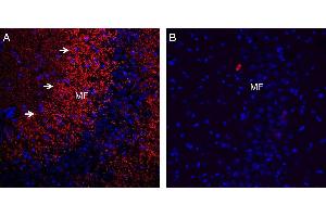 Expression of Synaptophysin in rat hippocampus. (Synaptophysin antibody  (Intravesicular Loop))