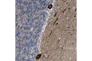 Immunohistochemical staining of human cerebellum with PCNXL3 polyclonal antibody  shows strong cytoplasmic positivity in Purkinje cells. (PCNXL3 antibody)