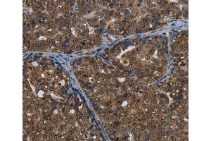 Immunohistochemistry of Human brain  using CERS6 Polyclonal Antibody at dilution of 1:35