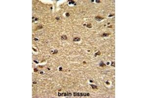 Immunohistochemistry (IHC) image for anti-Clusterin Associated Protein 1 (CLUAP1) antibody (ABIN3002721) (CLUAP1 antibody)