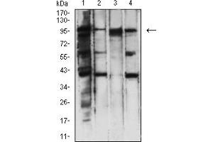 Western Blotting (WB) image for anti-PMS2 Postmeiotic Segregation Increased 2 (S. Cerevisiae) (PMS2) (AA 748-851) antibody (ABIN7193488)