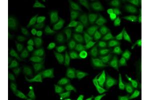 Immunofluorescence analysis of HeLa cells using IMPDH2 antibody (ABIN6130493, ABIN6142435, ABIN6142436 and ABIN6220985). (IMPDH2 antibody  (AA 215-514))