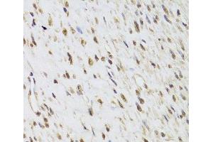 Immunohistochemistry of paraffin-embedded Human leiomyoma of uterus using SEPHS1 Polyclonal Antibody at dilution of 1:100 (40x lens). (SEPHS1 antibody)