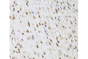 Immunohistochemistry of paraffin-embedded Human leiomyoma of uterus using SEPHS1 Polyclonal Antibody at dilution of 1:100 (40x lens).
