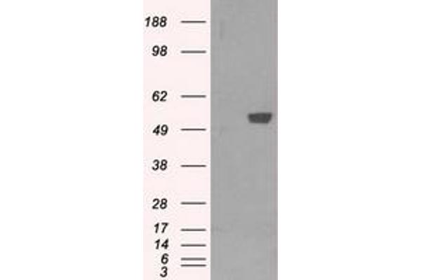 PFKFB4 antibody