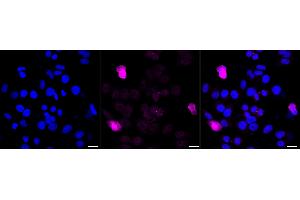 Immunocytochemical staining of HepG2 cells with MEK5 antibody (ABIN7799467), 1:1,000).