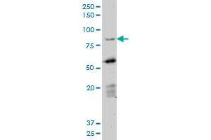 Western Blotting (WB) image for anti-Deleted in Azoospermia 1 (DAZ1) (AA 21-121) antibody (ABIN598639) (DAZ1 antibody  (AA 21-121))