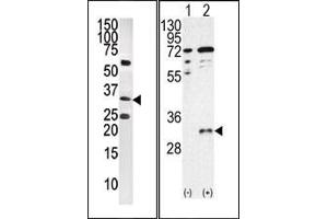 Image no. 1 for anti-CTD (Carboxy-terminal Domain, RNA Polymerase II, Polypeptide A) Small Phosphatase 1 (CTDSP1) (AA 1-250), (C-Term), (N-Term) antibody (ABIN360805) (CTDSP1 antibody  (C-Term, N-Term))