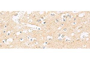 Immunohistochemistry of paraffin-embedded Human brain tissue using MRPL20 Polyclonal Antibody at dilution of 1:60(x200) (MRPL20 antibody)