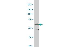 RASGRP2 polyclonal antibody (A01), Lot # NIH47060208QCS1 Western Blot analysis of RASGRP2 expression in A-431 . (RASGRP2 antibody  (AA 65-164))